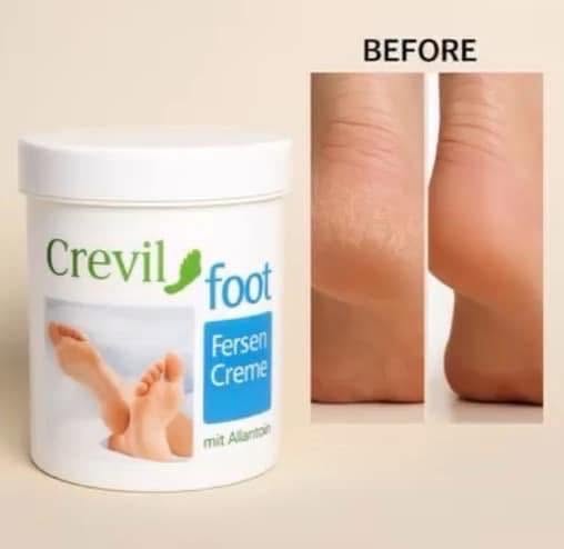 德國Crevil 足跟滋潤護理霜