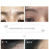 零逗留B5淨化平衡精華 30ml