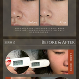 acetino 二合一迷你膠囊美容儀