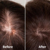 breo倍輕鬆 倍摩梳二代雙紅光按摩梳Scalp 3s